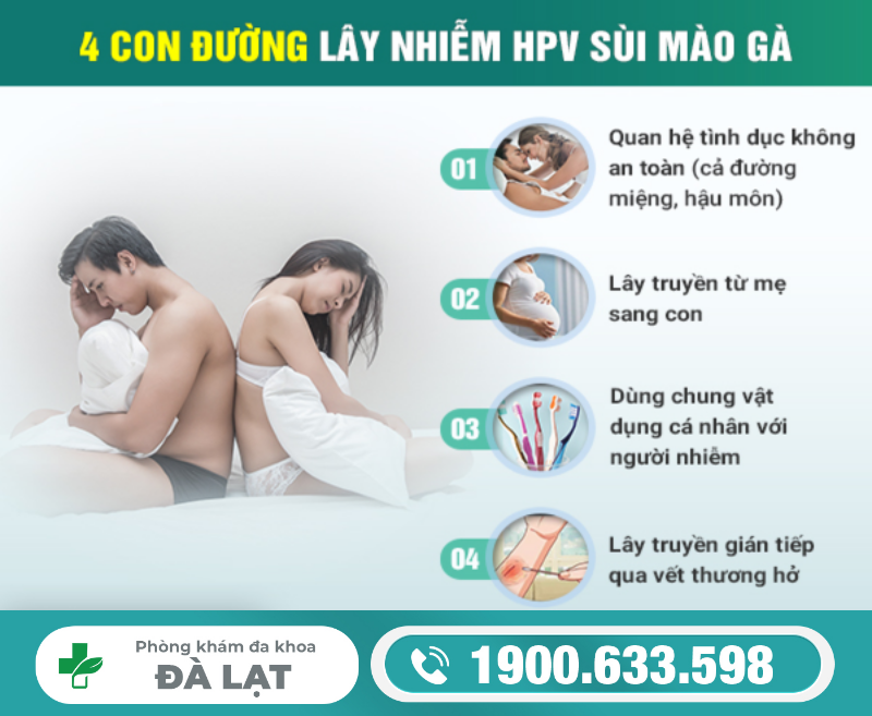 Hình ảnh minh họa